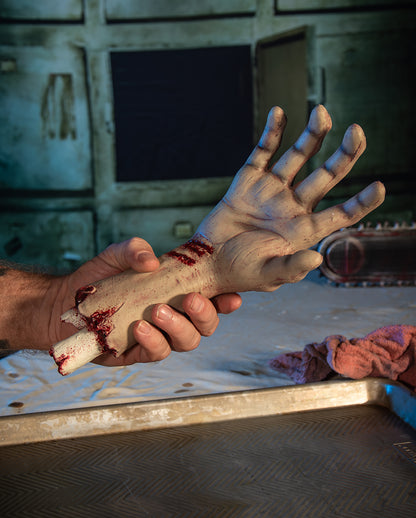 Abgehacktes Autopsie Hand mit Unterarm