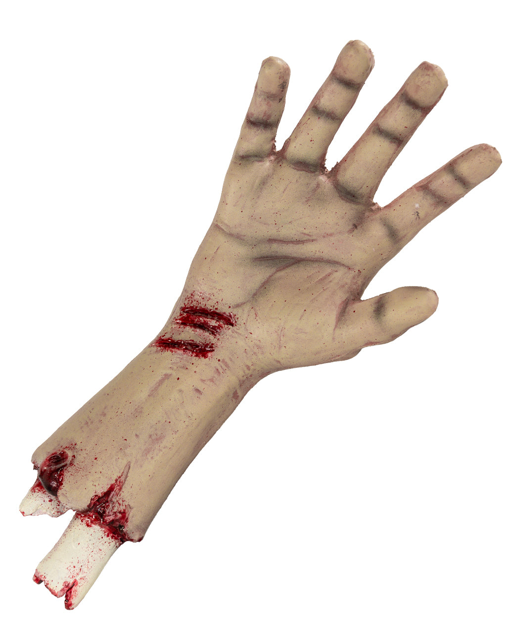 Abgehacktes Autopsie Hand mit Unterarm