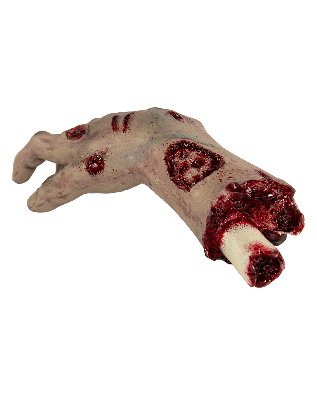 Abgehacktes Autopsie Hand mit Unterarm