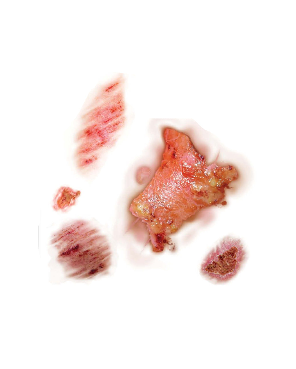 Infizierte Wunden Tattoos