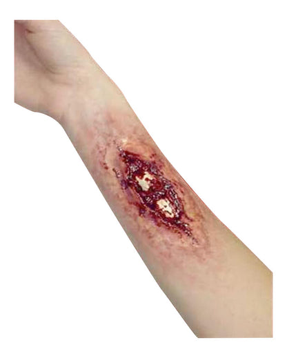 Knochenbruch / Broken Bone Wunde
