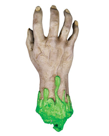 Abgetrennte Radioaktive Verseuchte Hand